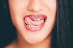 Natural Remedies for Tongue Ulcers
