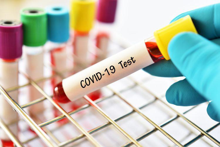 Low cost PCR kits to detect COVID-19