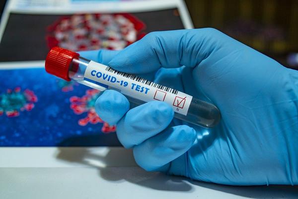 ICMR issues new COVID-19 testing guidelines