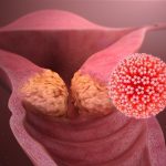 M-Strip: A simple innovation for early cervical cancer detection